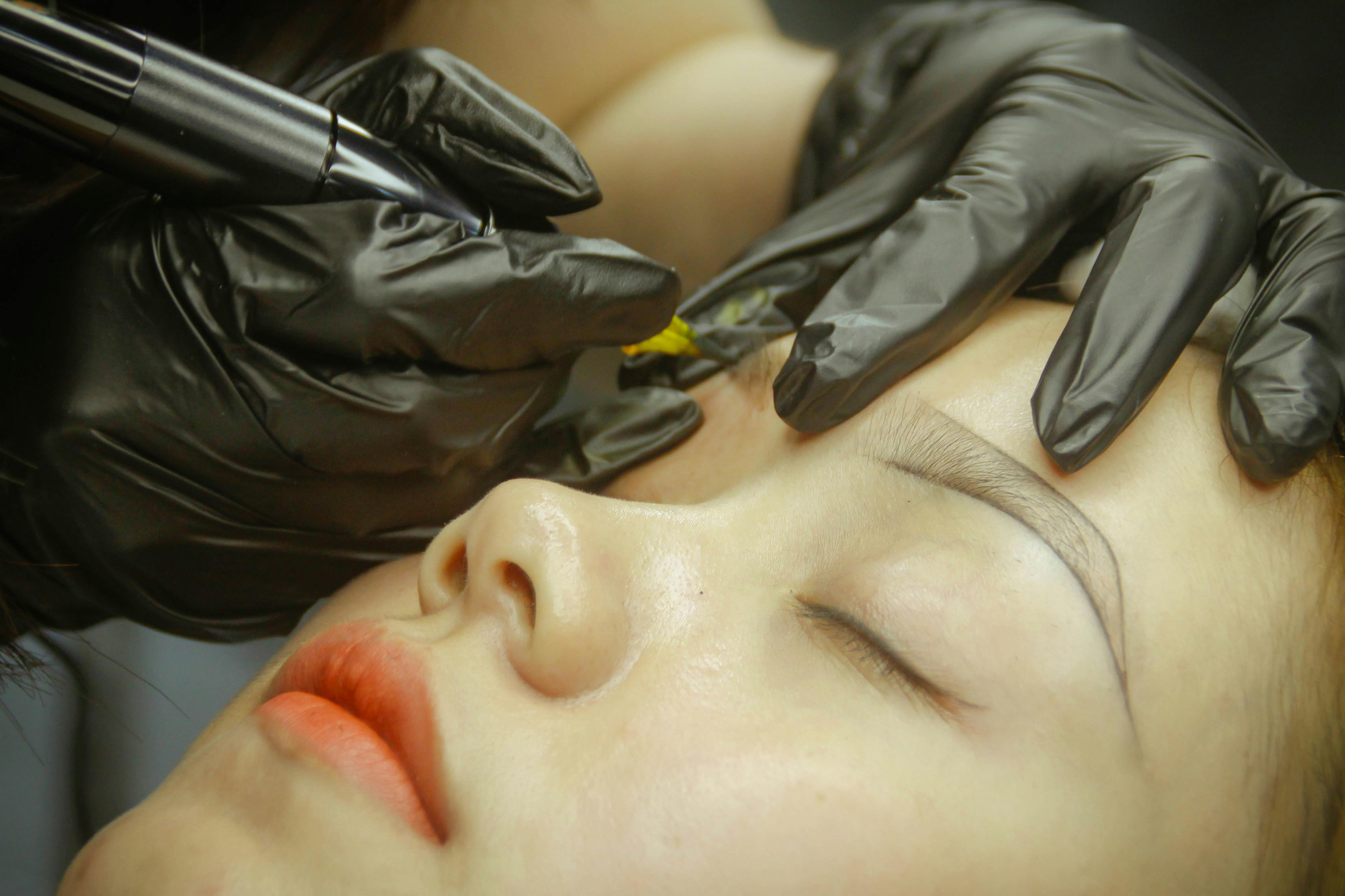 Browlift